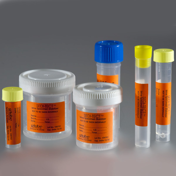 Urine Stabilization Products