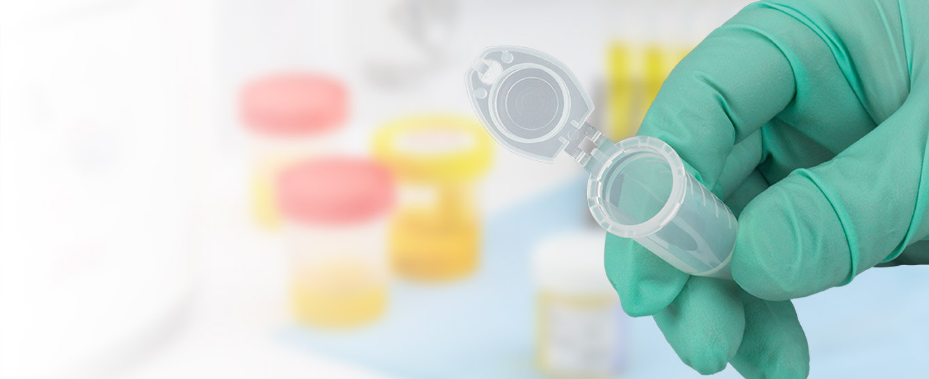 Save on Globe Scientific Locking Microcentrifuge Tubes
